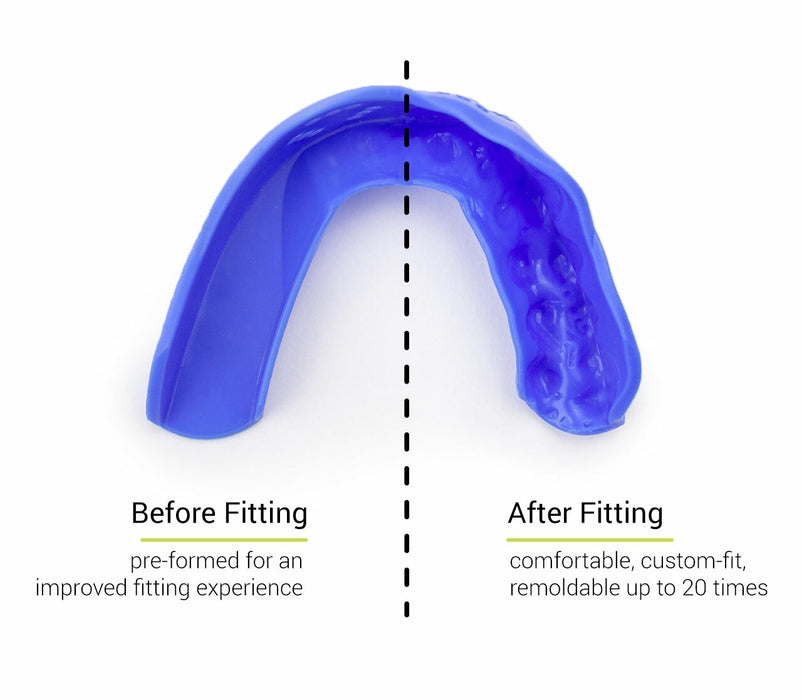 Sisu 3D Mouthguard - DiscoSports