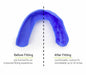 Sisu 3D Mouthguard - DiscoSports